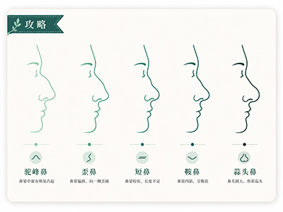 Comprehensive solution to nasal deformity correction